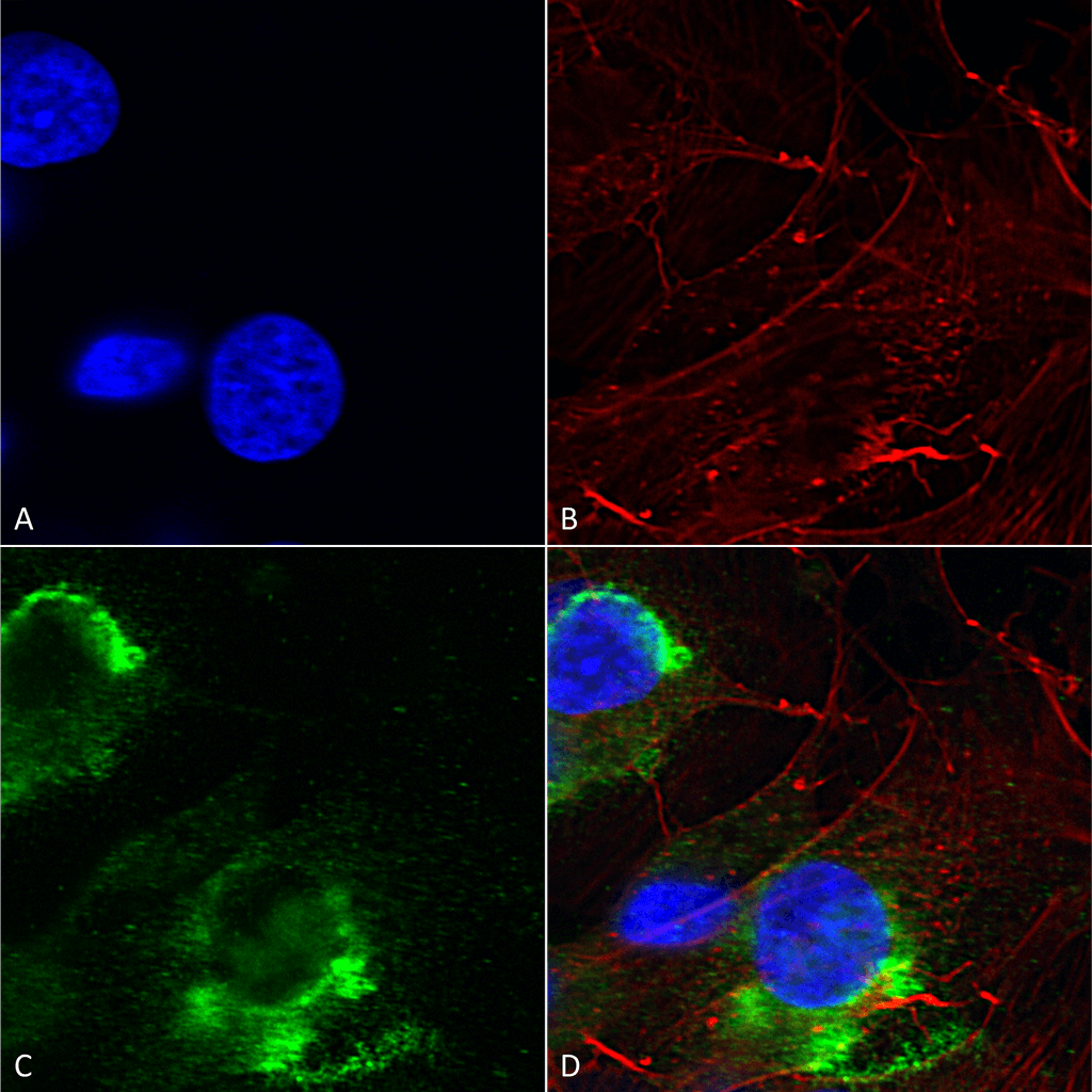  - GFAP R416WT Antibody ASM10276