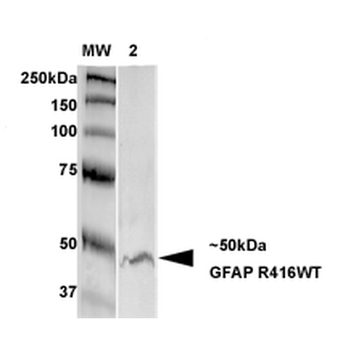 WB - GFAP R416WT Antibody ASM10276