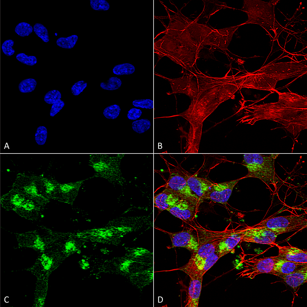  - VDAC1 Antibody ASM10290