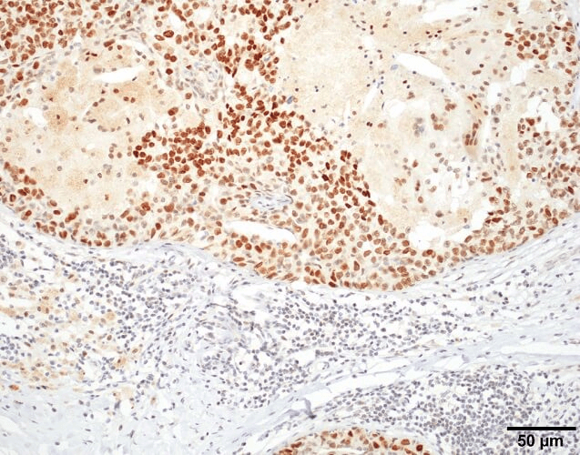 IHC - HSF1 Antibody ASM10308