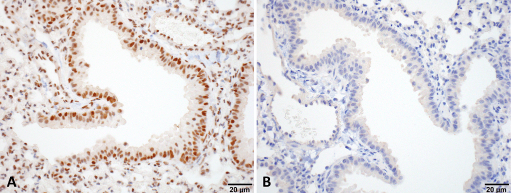 IHC - HSF1 Antibody ASM10308