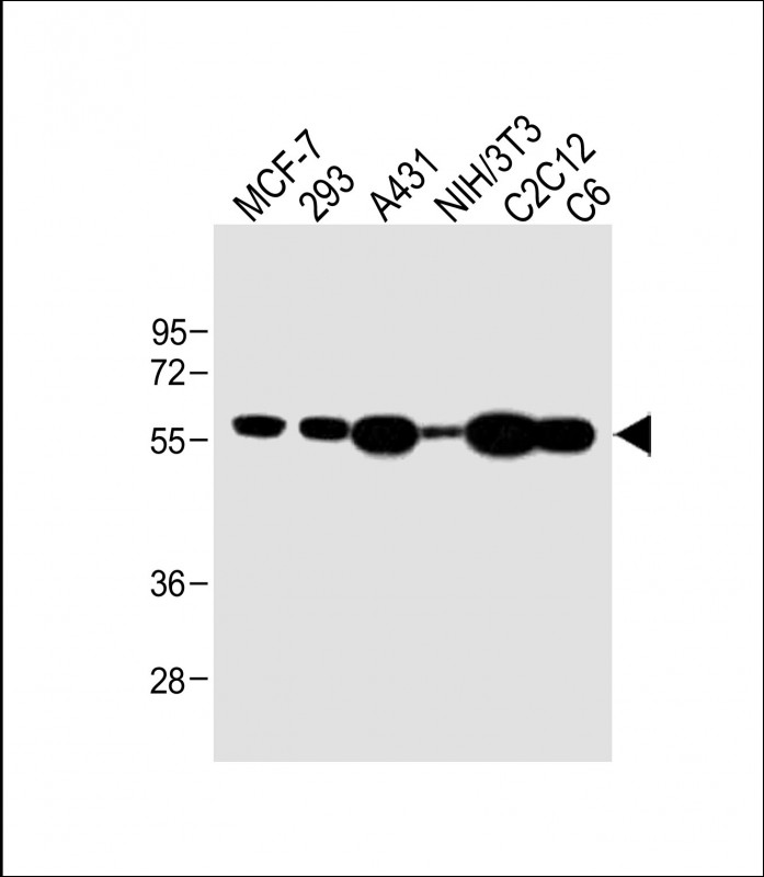 All lanes : Anti-Bi(YES1-Y537-SRC-Y530) Antibody at 1:1000 dilutionLane 1: MCF-7 whole cell lysateLane 2: 293 whole cell lysateLane 3: A431 whole cell lysateLane 4: NIH/3T3 whole cell lysateLane 5: C2C12 whole cell lysateLane 6: C6 whole cell lysateLysates/proteins at 20 �g per lane. SecondaryGoat Anti-Rabbit IgG,  (H+L), Peroxidase conjugated at 1/10000 dilution. Predicted band size : 60 kDaBlocking/Dilution buffer: 5% NFDM/TBST.