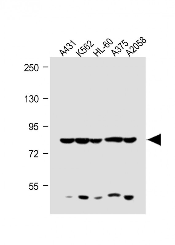 All lanes : Anti-ABCB5 Antibody (N-term) at 1:1000 dilutionLane 1: A431 whole cell lysateLane 2: K562 whole cell lysateLane 3: HL-60 whole cell lysateLane 4: A375 whole cell lysateLane 5: A2058 whole cell lysateLysates/proteins at 20 �g per lane. SecondaryGoat Anti-Rabbit IgG,  (H+L), Peroxidase conjugated at 1/10000 dilution. Predicted band size : 138 kDaBlocking/Dilution buffer: 5% NFDM/TBST.