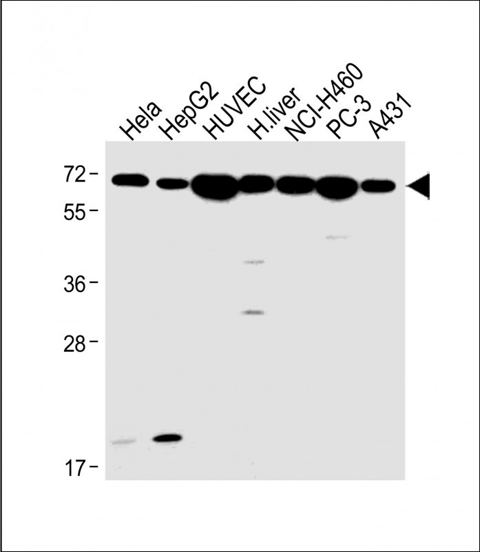 All lanes : Anti-ADRB2 Antibody (S364) at 1:1000 dilutionLane 1: Hela whole cell lysateLane 2: HepG2 whole cell lysateLane 3: HUVEC whole cell lysateLane 4: Human liver lysateLane 5: NCI-H460 whole cell lysateLane 6: PC-3 whole cell lysateLane 7: A431 whole cell lysateLysates/proteins at 20 �g per lane. SecondaryGoat Anti-Rabbit IgG,  (H+L), Peroxidase conjugated at 1/10000 dilution. Predicted band size : 46 kDaBlocking/Dilution buffer: 5% NFDM/TBST.