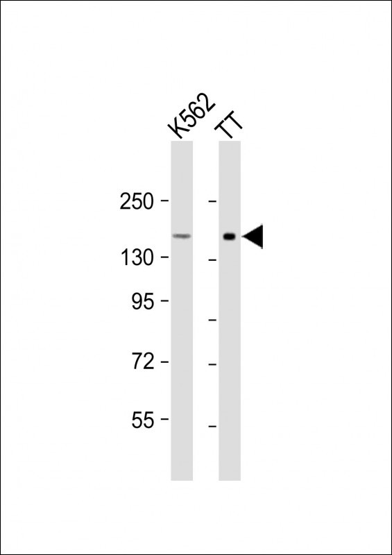 All lanes : Anti-c-KIT Antibody (C-term) at 1:1000 dilutionLane 1: K562 whole cell lysateLane 2: TT whole cell lysateLysates/proteins at 20 �g per lane. SecondaryGoat Anti-Rabbit IgG,  (H+L), Peroxidase conjugated at 1/10000 dilution. Predicted band size : 110 kDaBlocking/Dilution buffer: 5% NFDM/TBST.