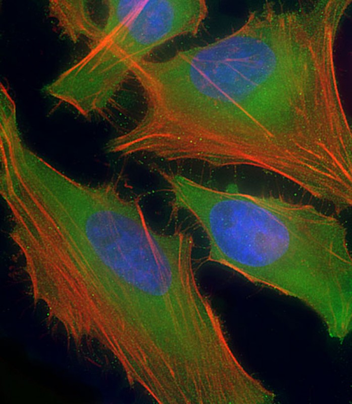 Immunofluorescent analysis of 4% paraformaldehyde-fixed, 0.1% Triton X-100 permeabilized HeLa (human cervical epithelial adenocarcinoma cell line) cells labeling ASS with AP6829c at 1/25 dilution, followed by Dylight� 488-conjugated goat anti-rabbit IgG (NK179883) secondary antibody at 1/200 dilution (green). Immunofluorescence image showing cytoplasm and nucleus staining on HeLa cell line. Cytoplasmic actin is detected with Dylight� 554 Phalloidin (PD18466410) at 1/100 dilution (red).The nuclear counter stain is DAPI (blue).