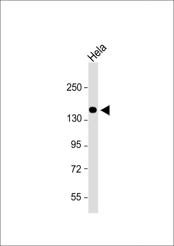 Anti-COL5A1 Antibody (N-term) at 1:2000 dilution + Hela whole cell lysateLysates/proteins at 20 ug per lane. SecondaryGoat Anti-Rabbit IgG,  (H+L), Peroxidase conjugated at 1/10000 dilution. Predicted band size : 184 kDaBlocking/Dilution buffer: 5% NFDM/TBST.