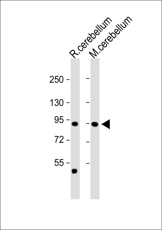 All lanes : Anti-TRPV1 Antibody (N-term) at 1:2000 dilutionLane 1: Rat cerebellum lysateLane 2: Mouse cerebellum  lysateLysates/proteins at 20 ug per lane. SecondaryGoat Anti-Rabbit IgG,  (H+L), Peroxidase conjugated at 1/10000 dilution. Predicted band size : 95 kDaBlocking/Dilution buffer: 5% NFDM/TBST.
