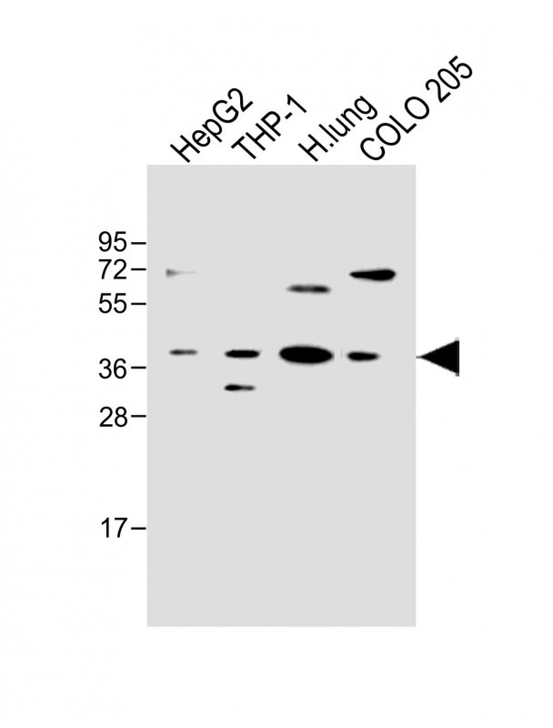 All lanes : Anti-FCGRT Antibody (C-term) at 1:500 dilutionLane 1: HepG2 whole cell lysateLane 2: THP-1 whole cell lysateLane 3: Human lung lysateLane 4: COLO 205 whole cell lysateLysates/proteins at 20 ug per lane. SecondaryGoat Anti-Rabbit IgG,  (H+L), Peroxidase conjugated at 1/10000 dilution. Predicted band size : 40 kDaBlocking/Dilution buffer: 5% NFDM/TBST.