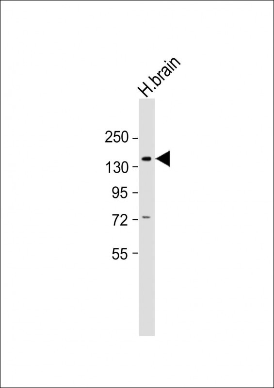 Anti-hABCB4-S639 at  1:2000  dilution + Human brain lysateLysates/proteins at 20 �g per lane. SecondaryGoat Anti-Rabbit IgG,  (H+L), Peroxidase conjugated at 1/10000 dilution. Predicted band size : 142 kDaBlocking/Dilution buffer: 5% NFDM/TBST.