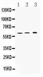 WB - Anti-ATP4B Picoband Antibody ABO10342