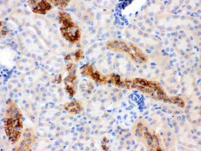 IHC - Anti-Calbindin-D Antibody (Monoclonal, CB-955) ABO10402