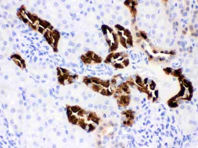 IHC - Anti-Calbindin-D Antibody (Monoclonal, CB-955) ABO10402