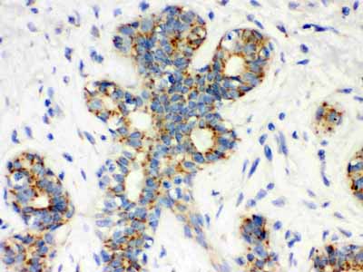 IHC - Anti-Calbindin-D Antibody (Monoclonal, CB-955) ABO10402