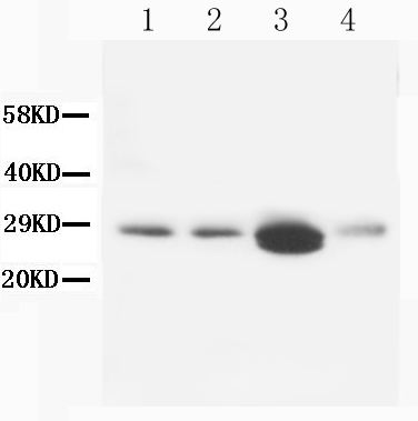 WB - Anti-Calbindin-D Antibody (Monoclonal, CB-955) ABO10402
