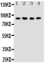 WB - Anti-NRG2 Antibody ABO10951