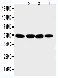 WB - Anti-Matrilin 3 Antibody ABO11230