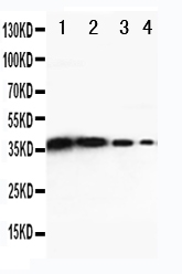 WB - Anti-DDX6 Antibody ABO11272