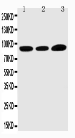 WB - Anti-TRPV3 Antibody ABO11286