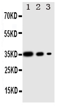 WB - Anti-PERK Antibody ABO11333