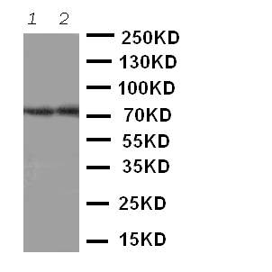 WB - Anti-ABCG4 Antibody ABO11373