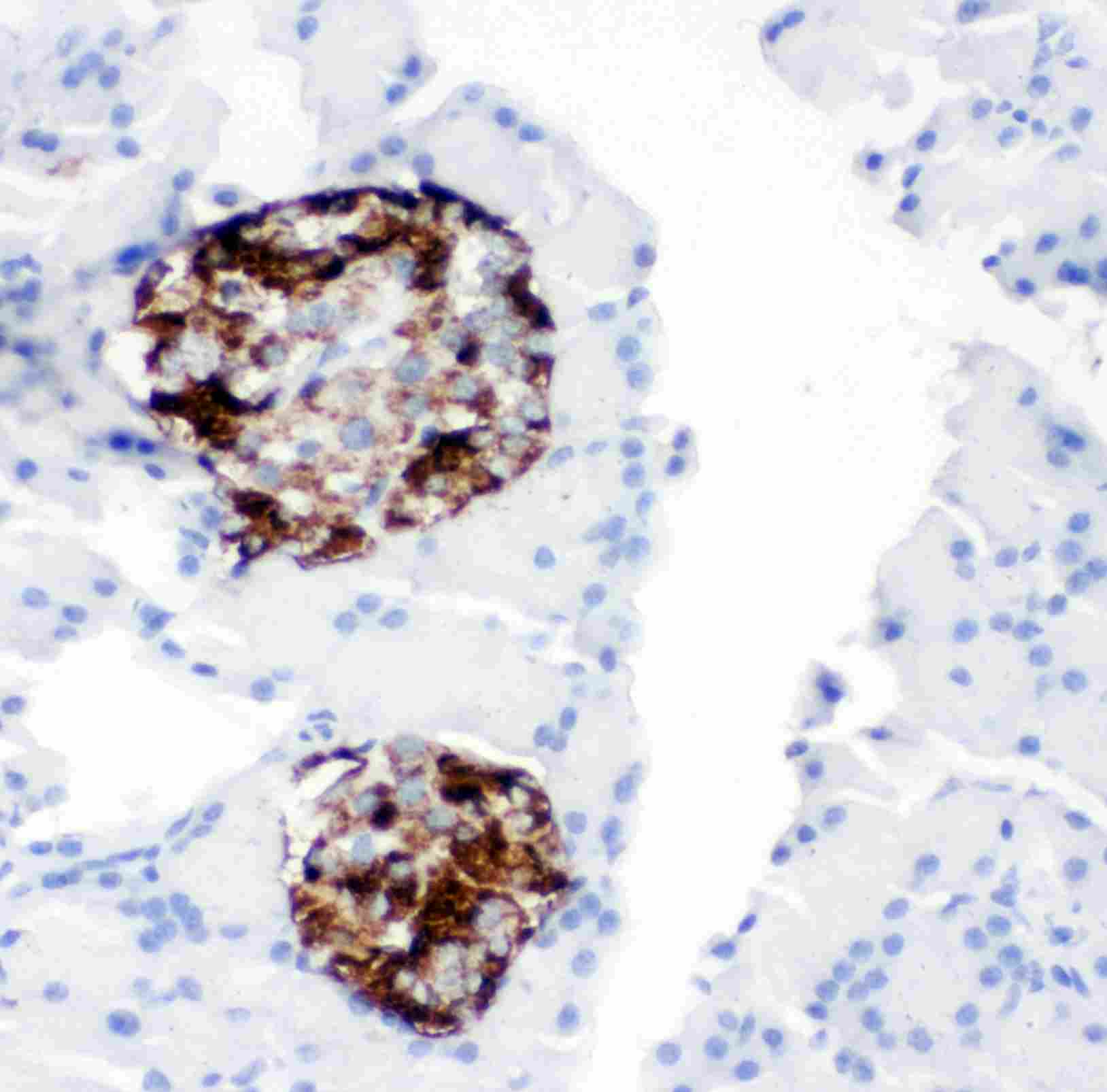 IHC - Anti-ProProtein Convertase 2 Antibody ABO11392
