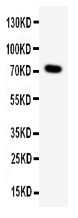 WB - Anti-ProProtein Convertase 2 Antibody ABO11392