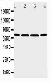 WB - Anti-P2X6 Antibody ABO11436