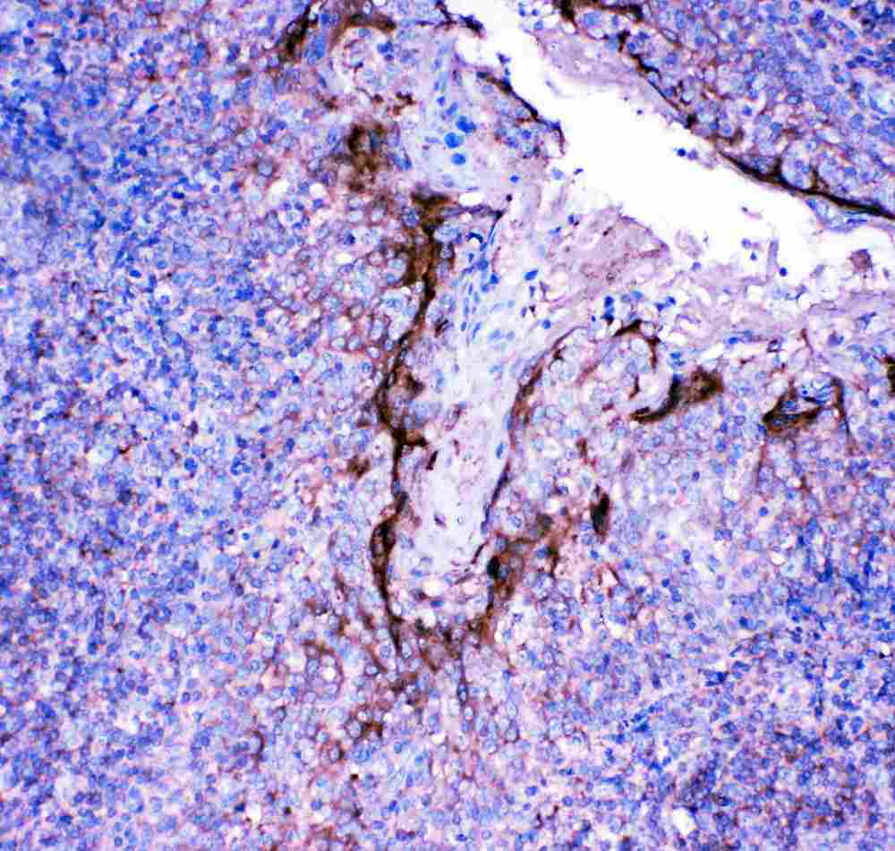 IHC - Anti-Profilin 2 Antibody ABO11473