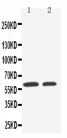 WB - Anti-SLC22A1 Antibody ABO11483