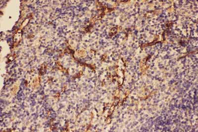IHC - Anti-complement C5a Antibody ABO11616