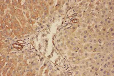IHC - Anti-complement C5a Antibody ABO11616