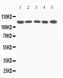 WB - Anti-complement C5a Antibody ABO11616