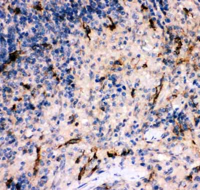 IHC - Anti-complement C5a Antibody ABO11879