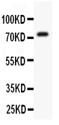 WB - Anti-Kv4.3 Picoband Antibody ABO11920