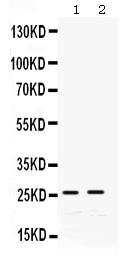 WB - Anti-GSTA1/A2/A3/A4/A5 Picoband Antibody ABO12313