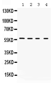 WB - Anti-Kv1.2 Picoband Antibody ABO12335
