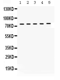 WB - Anti-KIF3A Picoband Antibody ABO12340