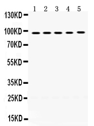 WB - Anti-MCM8 Picoband Antibody ABO12408