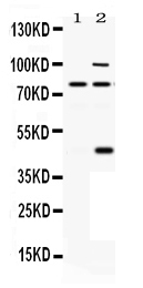 WB - Anti-PACE4 Picoband Antibody ABO12455