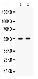 WB - Anti-GLUT9 Picoband Antibody ABO12577