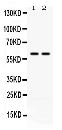 WB - Anti-CCT3 Picoband Antibody ABO12611