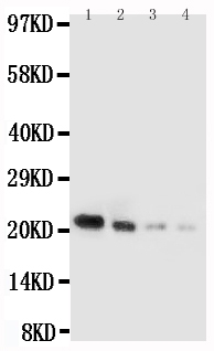 WB - Anti-IL-18 Antibody ABO12702