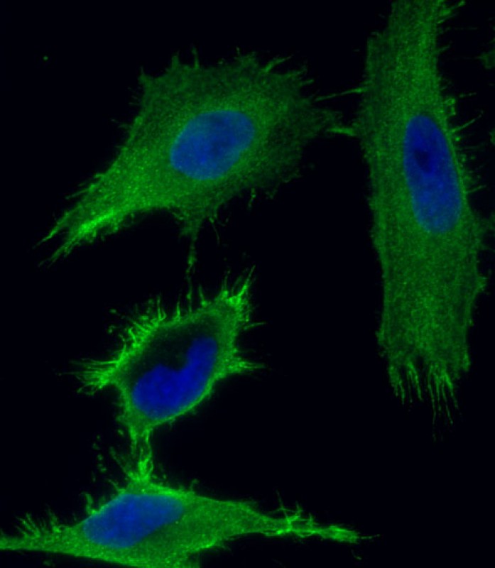 Immunofluorescent analysis of 4% paraformaldehyde-fixed, 0.1% Triton X-100 permeabilized HeLa (human cervical epithelial adenocarcinoma cell line) cells labeling CTNNB1 with AM8631b at 1/25 dilution, followed by Dylight� 488-conjugated goat anti-mouse IgG (NH174309) secondary antibody at 1/200 dilution (green). Immunofluorescence image showing membrane staining on HeLa cell line. Cytoplasmic actin is detected with Dylight� 554 Phalloidin (OI17558410) at 1/100 dilution (red). The nuclear counter stain is DAPI (blue).