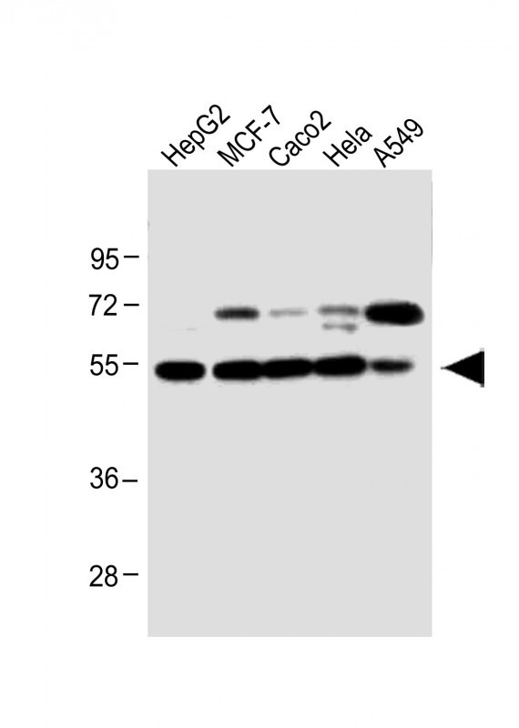 All lanes : Anti-CLU Antibody (N-term) at 1:1000 dilutionLane 1: HepG2 whole cell lysateLane 2: MCF-7 whole cell lysateLane 3: Caco2 whole cell lysateLane 4: Hela whole cell lysateLane 5: A549 whole cell lysateLysates/proteins at 20 �g per lane. SecondaryGoat Anti-Rabbit IgG,  (H+L), Peroxidase conjugated at 1/10000 dilution. Predicted band size : 52 kDaBlocking/Dilution buffer: 5% NFDM/TBST.