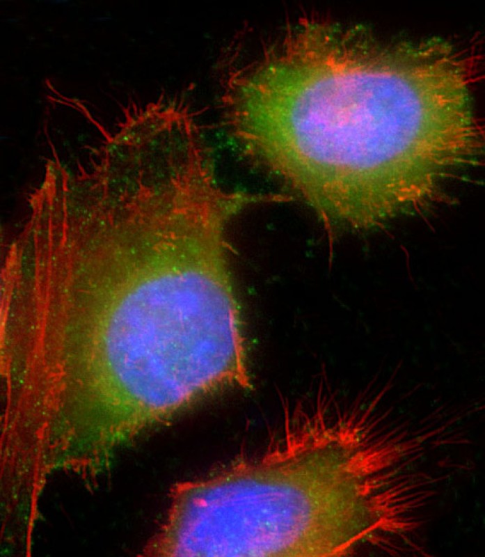 Immunofluorescent analysis of 4% paraformaldehyde-fixed, 0.1% Triton X-100 permeabilized HeLa (human cervical epithelial adenocarcinoma cell line) cells labeling HSD17B10 with AP22211c at 1/25 dilution, followed by Dylight� 488-conjugated goat anti-rabbit IgG (1583138) secondary antibody at 1/200 dilution (green). Immunofluorescence image showing cytoplasm and nucleus staining on HeLa cell line. Cytoplasmic actin is detected with Dylight� 554 Phalloidin (OI17558410) at 1/100 dilution (red). The nuclear counter stain is DAPI (blue).