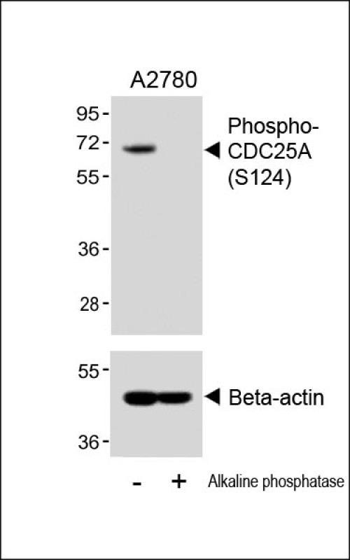 WB - Phospho-CDC25A(S124) Antibody AP3045a