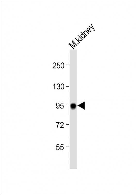WB - MEP1A Antibody (N-term) AP5858a