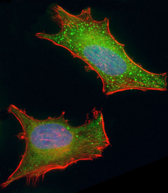 Immunofluorescent analysis of 4% paraformaldehyde-fixed, 0.1% Triton X-100 permeabilized HeLa (human cervical epithelial adenocarcinoma cell line) cells labeling BMI1 with AP8756a at 1/25 dilution, followed by Dylight� 488-conjugated goat anti-rabbit IgG (1583138) secondary antibody at 1/200 dilution (green). Immunofluorescence image showing cytoplasm and nucleus staining on HeLa cell line. Cytoplasmic actin is detected with Dylight� 554 Phalloidin (OI17558410) at 1/100 dilution (red). The nuclear counter stain is DAPI (blue).