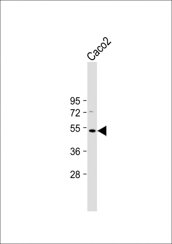 WB - OTUD3 Antibody (Center) AP11031C